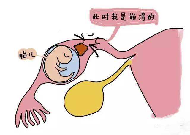 上海医院要捐卵，上海三代试管婴儿医院排名哪家强？上海试管医院推荐